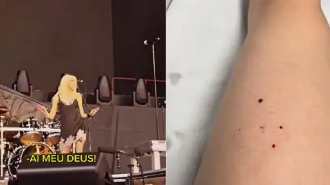 Taylor Momsen, do Pretty Reckless, é mordida por morcego durante show. Veja!