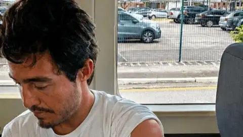 Tiago Iorc sobe faz show em Belém mesmo após ser mordido por cachorro no rosto
